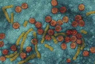 World Hepatitis Day Special: Where Have We Reached So Far?
