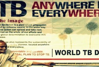 Is Tuberculosis Still A Deadly Disease In India?