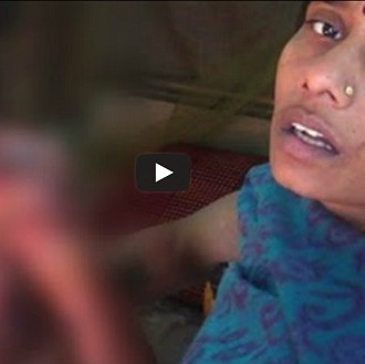 She Opposed Sexual Harassment, And She Was Burnt With Acid; Will You Help Her Fight Back?