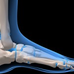 Osteoporosis: Don’t Let Brittle Bones Shatter Your Life